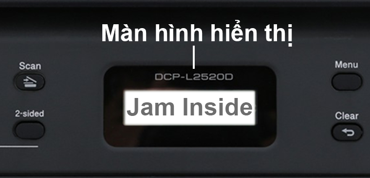 Kẹt màn hình báo thức